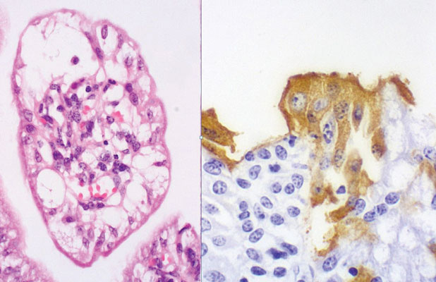 clinical pathology slide