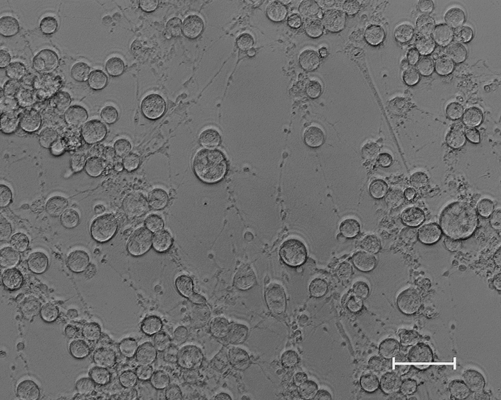 microscopic image of equine herpesvirus